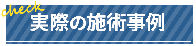 実際の施術事例